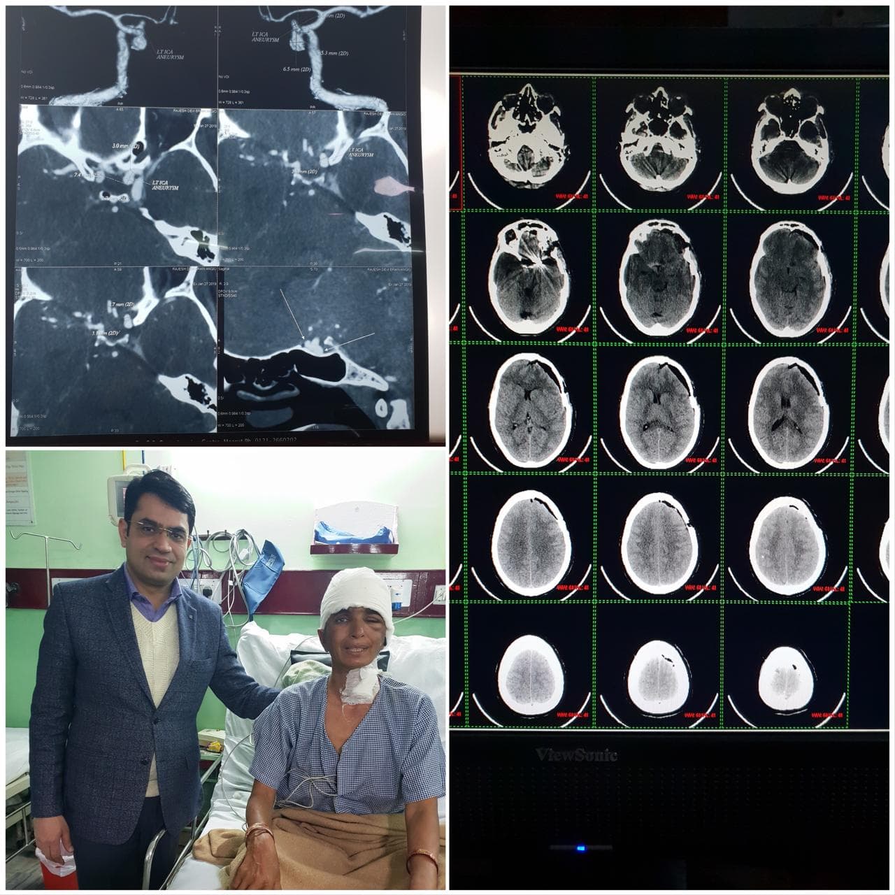 Brain Surgery