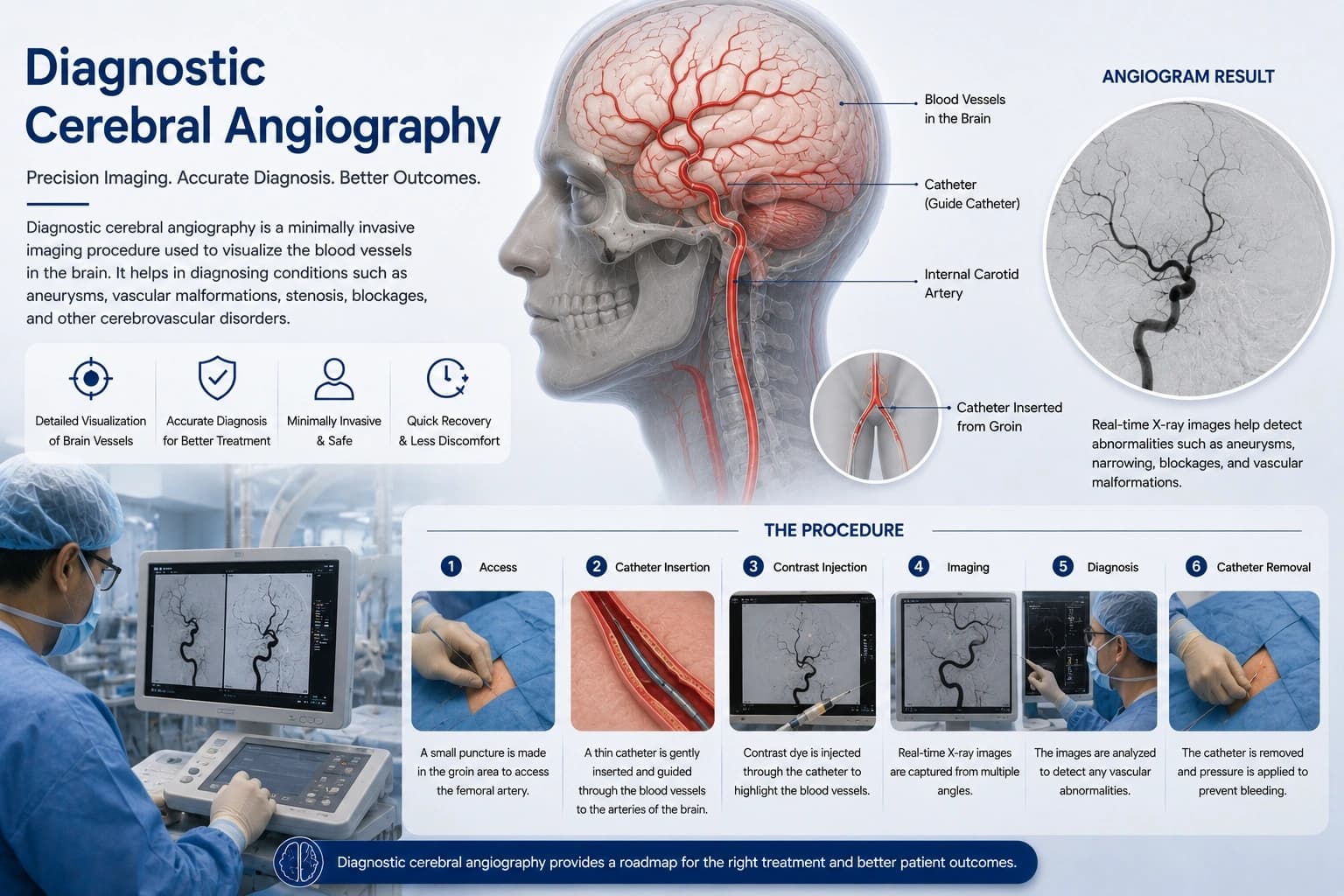 Diagnostic Cerebral Angiography